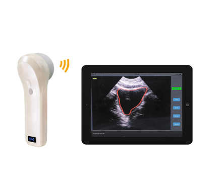 BProbe-2四维扫描无线探头式膀胱仪