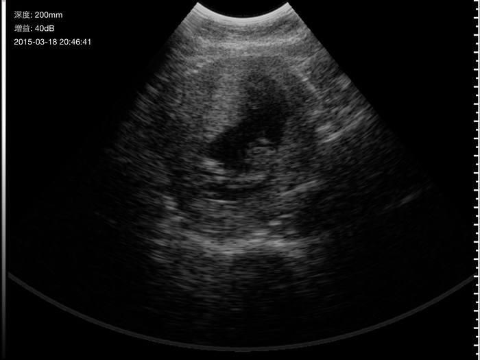 胚胎图像（UProbe-1 智能无线兽用B超）
