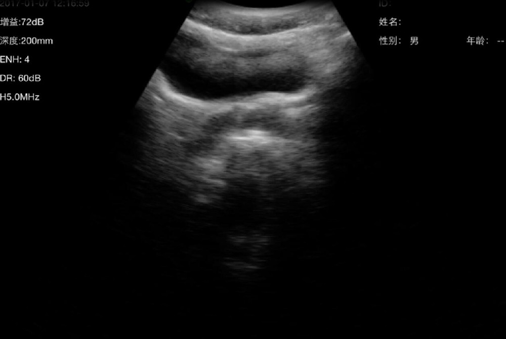 膀胱、前列腺图像视频