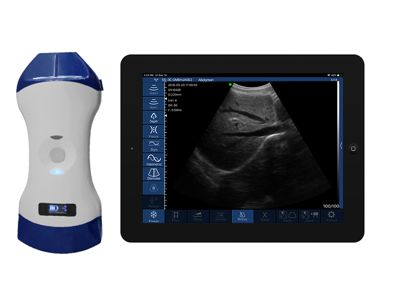 5CP 2in1 palm doppler ultrasound